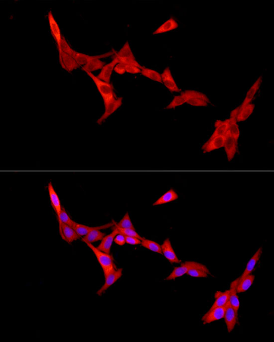 PFKL Rabbit polyclonal antibody