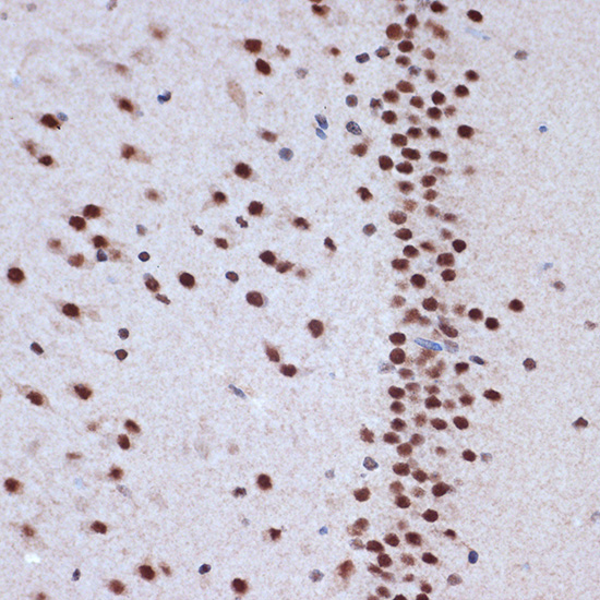 ACTL6A Rabbit monoclonal antibody