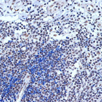 ACTL6A Rabbit monoclonal antibody
