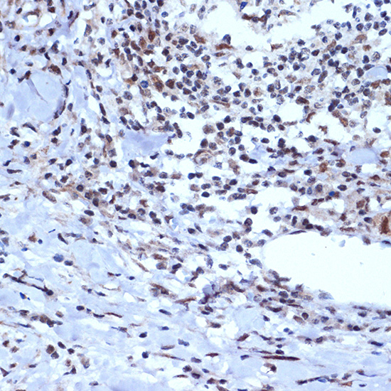 ACTL6A Rabbit monoclonal antibody