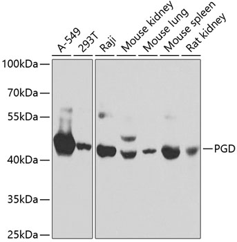 PGD Rabbit polyclonal antibody