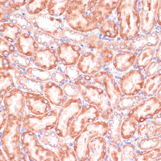 PGD Rabbit polyclonal antibody