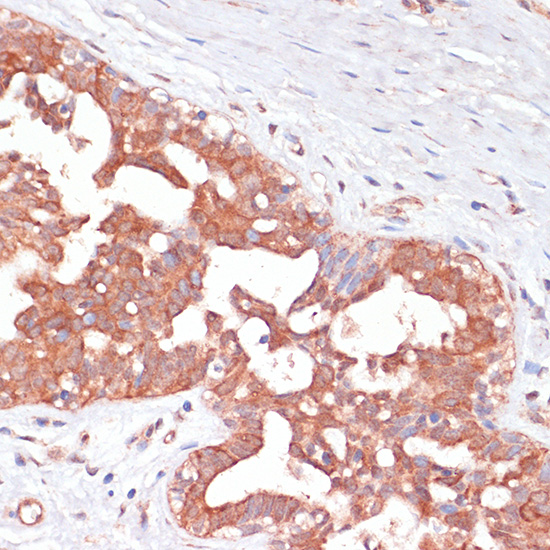 PGD Rabbit polyclonal antibody