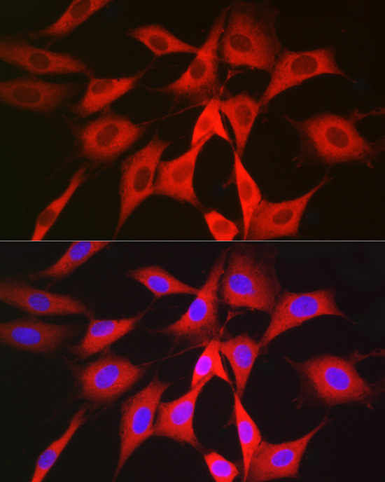 PGD Rabbit polyclonal antibody