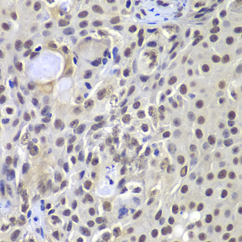 DNA-PKcs Rabbit polyclonal antibody