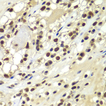 DNA-PKcs Rabbit polyclonal antibody