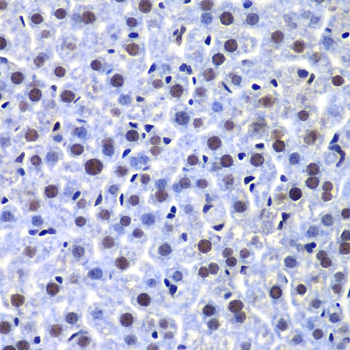 DNA-PKcs Rabbit polyclonal antibody