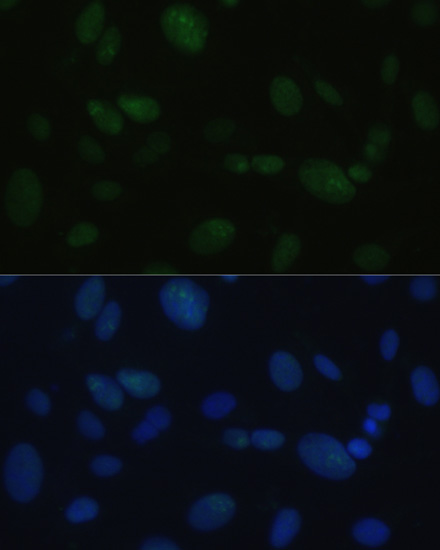 DNA-PKcs Rabbit polyclonal antibody