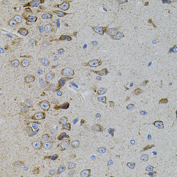 MAPK11 Rabbit polyclonal antibody