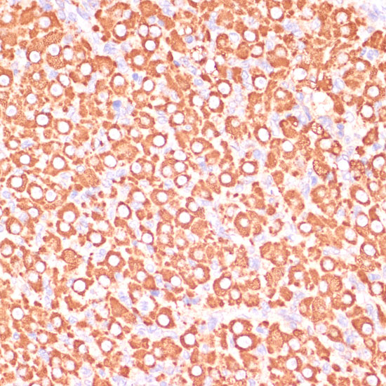 MEK3 Rabbit polyclonal antibody