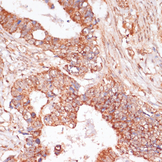 MEK3 Rabbit polyclonal antibody