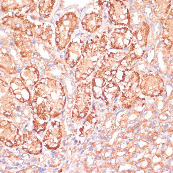 MEK3 Rabbit polyclonal antibody