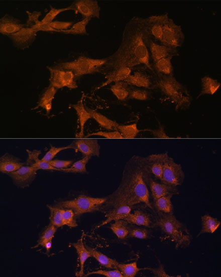 MEK3 Rabbit polyclonal antibody