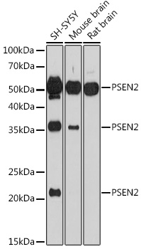 PSEN2 Rabbit polyclonal antibody