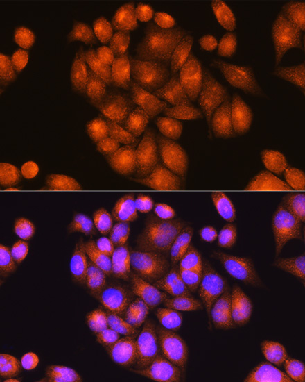 PSEN2 Rabbit polyclonal antibody