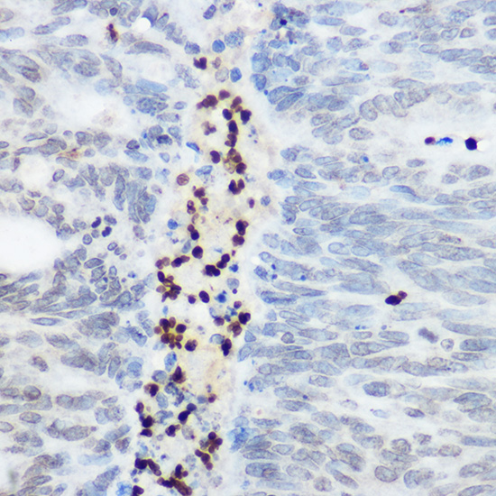 SHC1 Rabbit polyclonal antibody