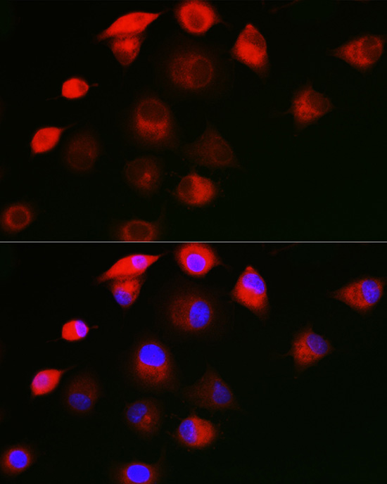 SHC1 Rabbit polyclonal antibody