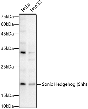 Sonic Hedgehog (Shh) Rabbit polyclonal antibody