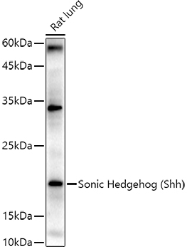 Sonic Hedgehog (Shh) Rabbit polyclonal antibody