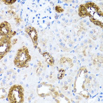 Sonic Hedgehog (Shh) Rabbit polyclonal antibody