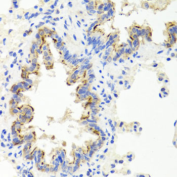 Sonic Hedgehog (Shh) Rabbit polyclonal antibody