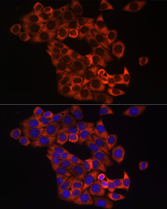 Sonic Hedgehog (Shh) Rabbit polyclonal antibody