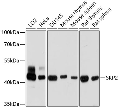 SKP2 Rabbit polyclonal antibody
