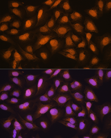SKP2 Rabbit polyclonal antibody