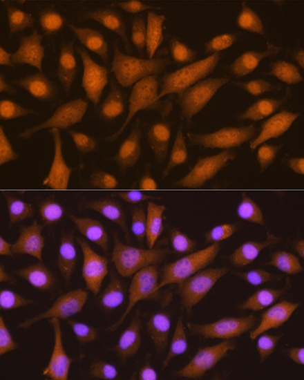 SKP2 Rabbit polyclonal antibody