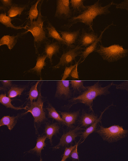 SKP2 Rabbit polyclonal antibody