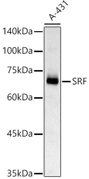 SRF Rabbit polyclonal antibody