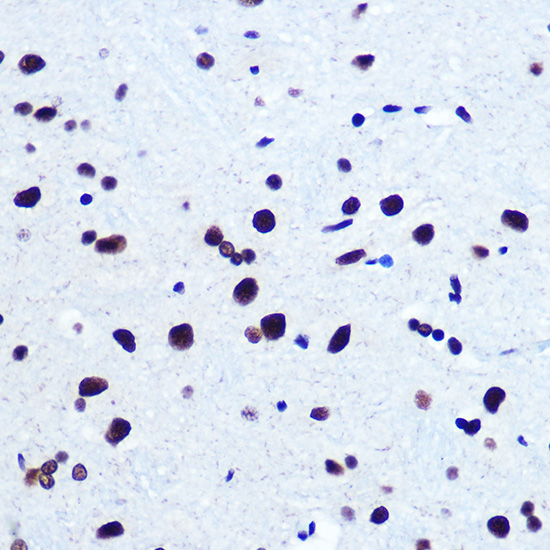 SRF Rabbit polyclonal antibody