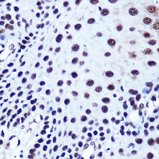 SRF Rabbit polyclonal antibody