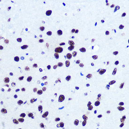 SRF Rabbit polyclonal antibody