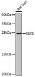 Western blot - SSX5 Rabbit pAb (A7732)
