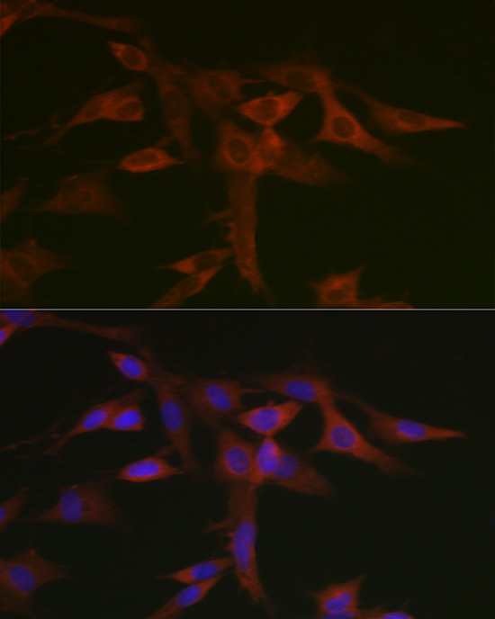 STAT5A Rabbit polyclonal antibody