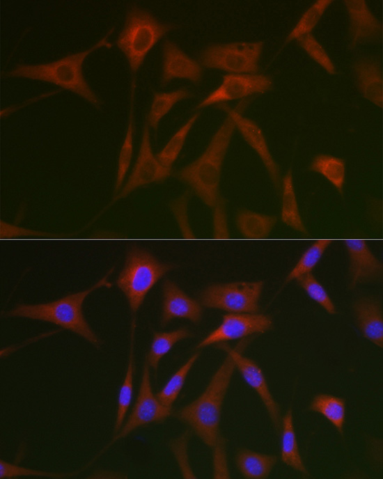 STAT5A Rabbit polyclonal antibody