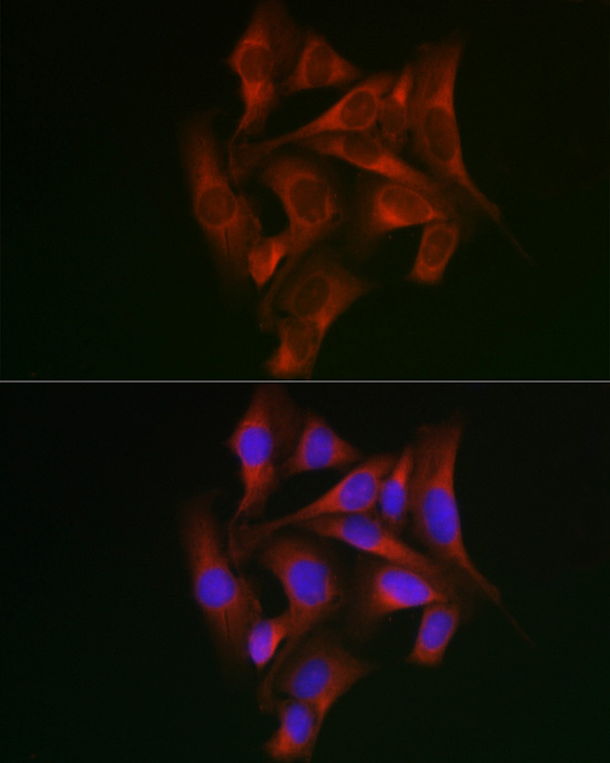 STAT5A Rabbit polyclonal antibody