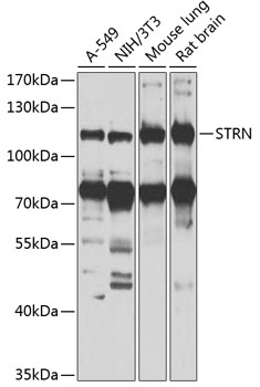 STRN Rabbit polyclonal antibody