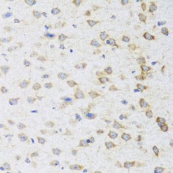 STRN Rabbit polyclonal antibody