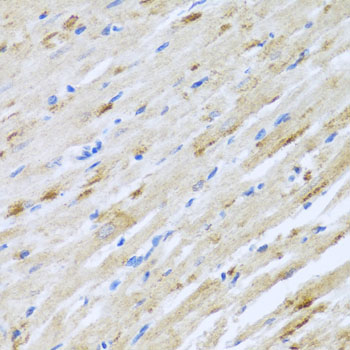 STRN Rabbit polyclonal antibody
