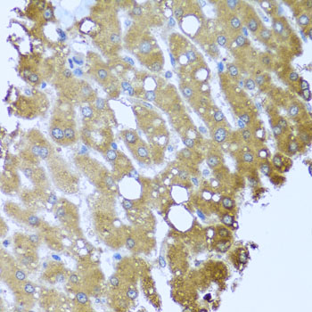 STRN Rabbit polyclonal antibody