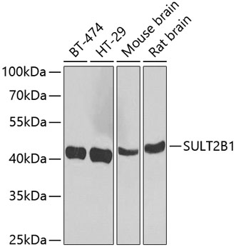 SULT2B1 Rabbit polyclonal antibody