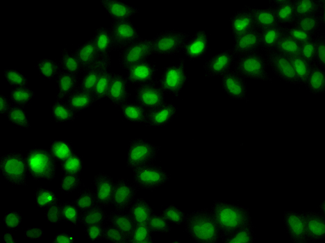 SULT2B1 Rabbit polyclonal antibody
