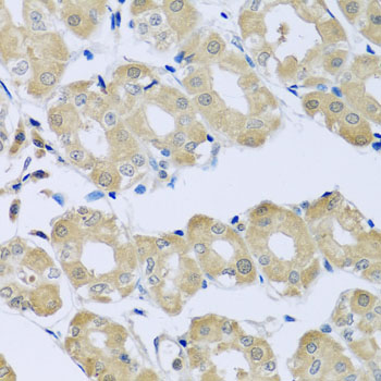 SYT4 Rabbit polyclonal antibody