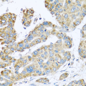 SYT4 Rabbit polyclonal antibody