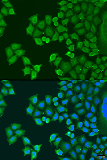 SYT4 Rabbit polyclonal antibody