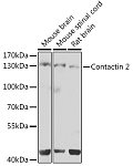Western blot - Contactin 2 Rabbit pAb (A7738)