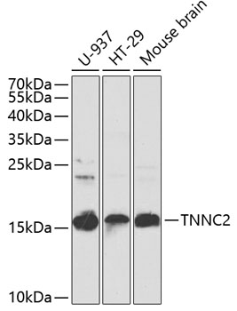 TNNC2 Rabbit polyclonal antibody
