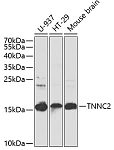 Western blot - TNNC2 Rabbit pAb (A7740)